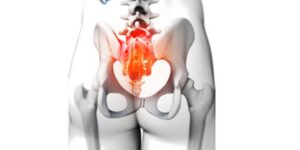 Scopri di più sull'articolo Cos’è la Sacralgia?